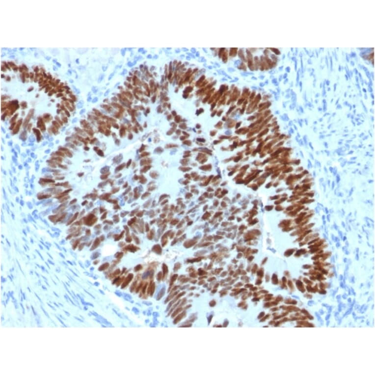 Immunohistochemistry - Anti-p53 Antibody [PCRP-TP53-2A10] - BSA and Azide free (A250173) - Antibodies.com