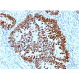 Immunohistochemistry - Anti-p53 Antibody [PCRP-TP53-2A10] - BSA and Azide free (A250173) - Antibodies.com