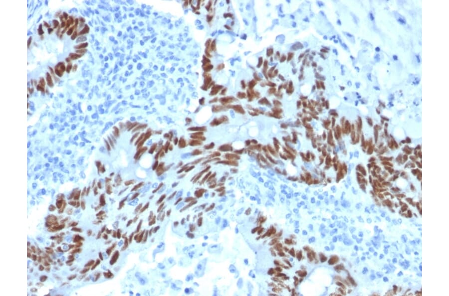 Immunohistochemistry - Anti-p53 Antibody [PCRP-TP53-1F7] - BSA and Azide free (A250174) - Antibodies.com