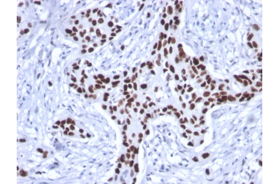 Immunohistochemistry - Anti-p53 Antibody [rTP53/1739] - BSA and Azide free (A253355) - Antibodies.com