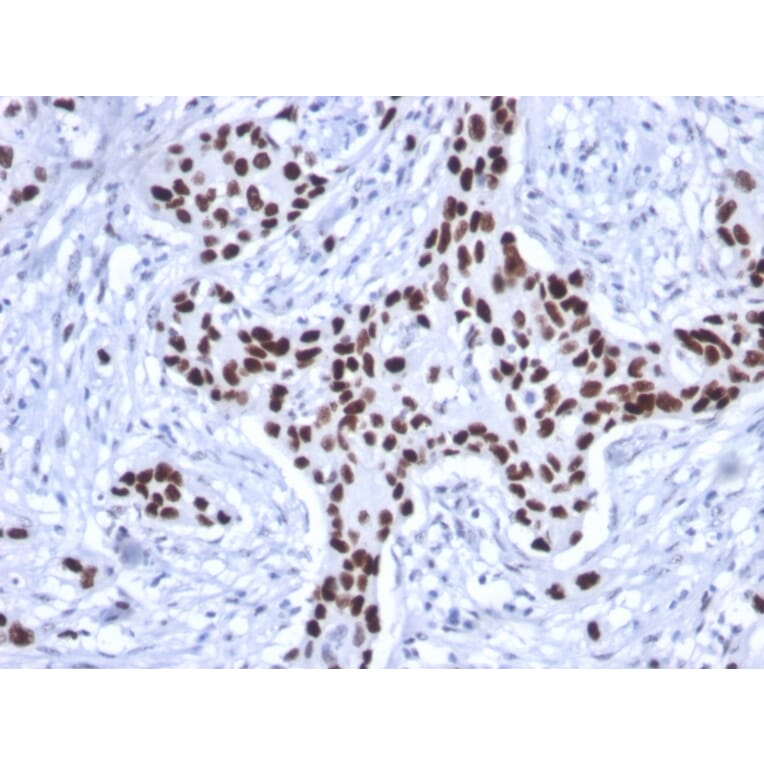 Immunohistochemistry - Anti-p53 Antibody [rTP53/1739] - BSA and Azide free (A253355) - Antibodies.com