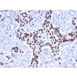 Immunohistochemistry - Anti-p53 Antibody [rTP53/1739] - BSA and Azide free (A253355) - Antibodies.com