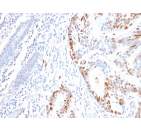 Immunohistochemistry - Anti-p53 Antibody [rBP53-12] - BSA and Azide free (A253356) - Antibodies.com
