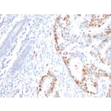 Immunohistochemistry - Anti-p53 Antibody [rBP53-12] - BSA and Azide free (A253356) - Antibodies.com