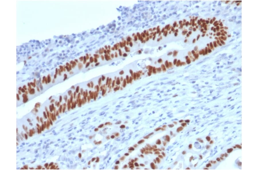 Immunohistochemistry - Anti-p53 Antibody [TP53/2719] - BSA and Azide free (A253356) - Antibodies.com