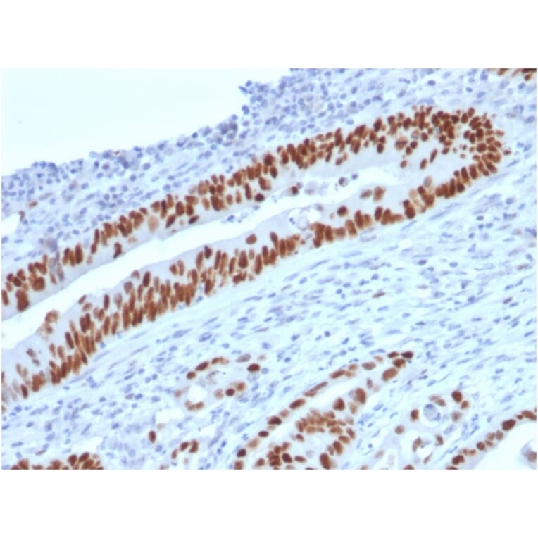 Immunohistochemistry - Anti-p53 Antibody [TP53/2719] - BSA and Azide free (A253356) - Antibodies.com