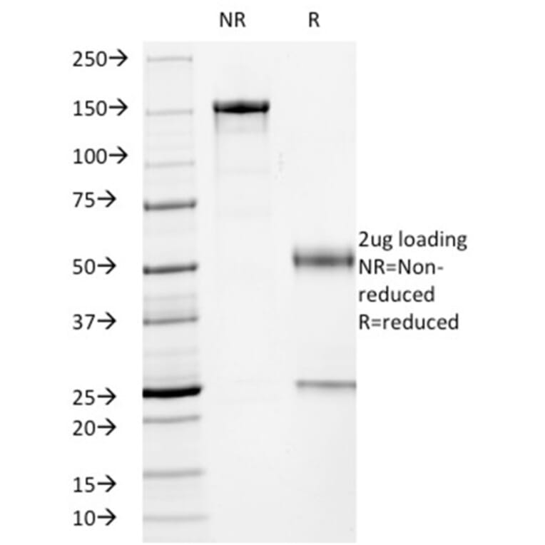 SDS-PAGE - Anti-p53 Antibody [TP53/2719] - BSA and Azide free (A253357) - Antibodies.com