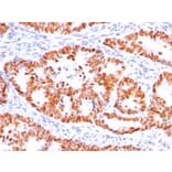Immunohistochemistry - Anti-p53 Antibody [BP53-12] - BSA and Azide free (A253357) - Antibodies.com