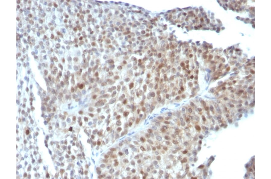Immunohistochemistry - Anti-p53 Antibody [SPM589] - BSA and Azide free (A253358) - Antibodies.com