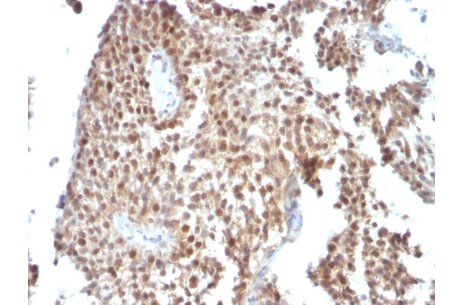 Immunohistochemistry - Anti-p53 Antibody [SPM590] - BSA and Azide free (A253360) - Antibodies.com