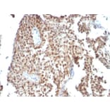 Immunohistochemistry - Anti-p53 Antibody [SPM590] - BSA and Azide free (A253360) - Antibodies.com