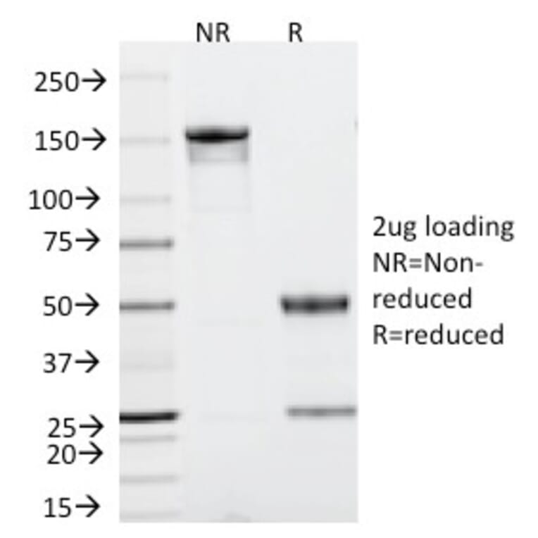 SDS-PAGE - Anti-p53 Antibody [TRP/816] - BSA and Azide free (A253364) - Antibodies.com