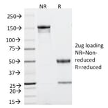 SDS-PAGE - Anti-p53 Antibody [TRP/816] - BSA and Azide free (A253364) - Antibodies.com