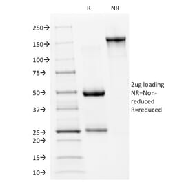 SDS-PAGE - Anti-p53 Antibody [PAb240] - BSA and Azide free (A253366) - Antibodies.com