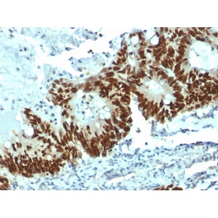 Immunohistochemistry - Anti-p53 Antibody [DO-1] - BSA and Azide free (A253368) - Antibodies.com