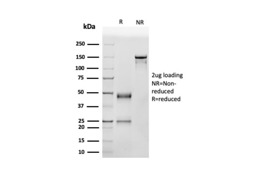 SDS-PAGE - Anti-p53 Antibody [SPM514] - BSA and Azide free (A250190) - Antibodies.com