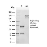 SDS-PAGE - Anti-p53 Antibody [SPM514] - BSA and Azide free (A250190) - Antibodies.com