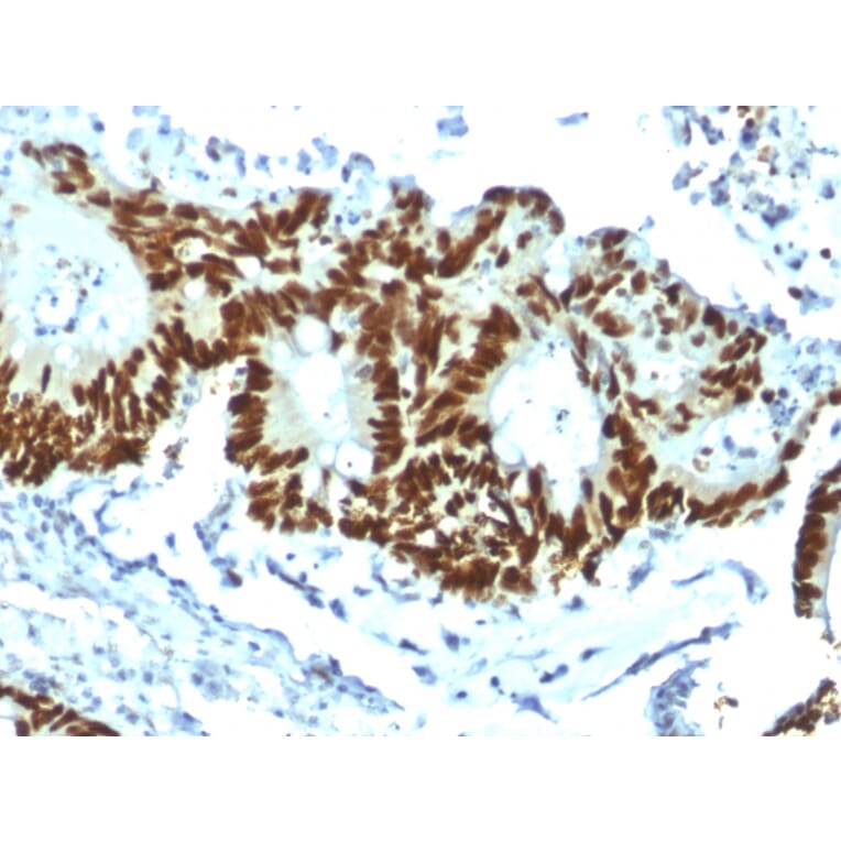 Immunohistochemistry - Anti-p53 Antibody [TP53/1799R] - BSA and Azide free (A253371) - Antibodies.com