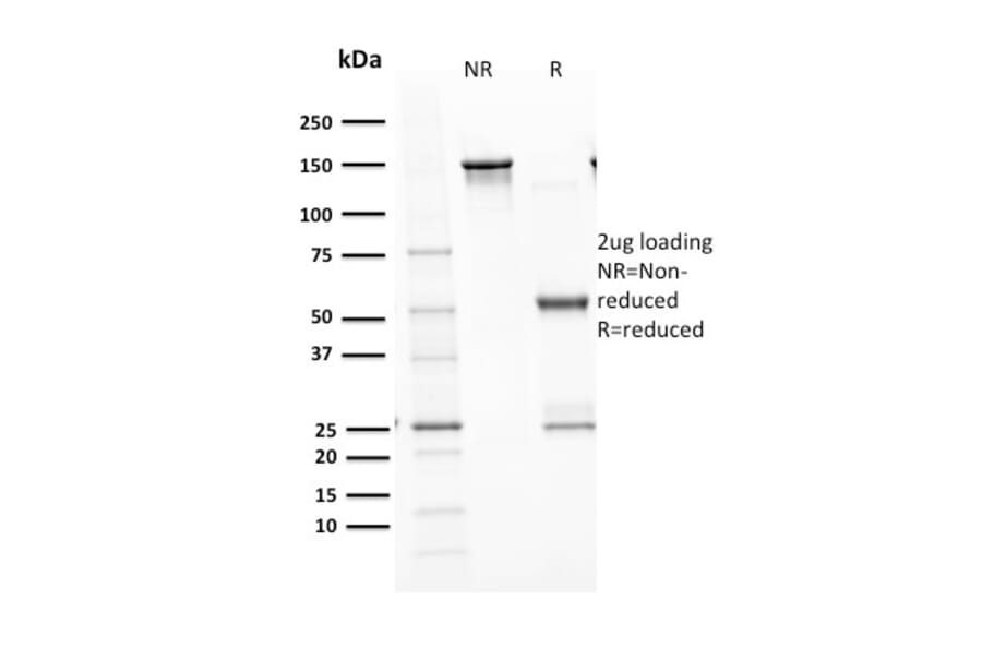 SDS-PAGE - Anti-p53 Antibody [TP53/1799R] - BSA and Azide free (A253371) - Antibodies.com