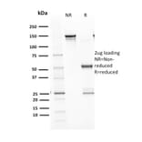 SDS-PAGE - Anti-p53 Antibody [TP53/1799R] - BSA and Azide free (A253371) - Antibodies.com