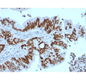 Immunohistochemistry - Anti-p53 Antibody [TP53/2092R] - BSA and Azide free (A253372) - Antibodies.com