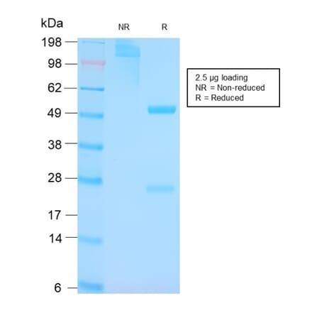 SDS-PAGE - Anti-p53 Antibody [TP53/3156R] - BSA and Azide free (A253372) - Antibodies.com