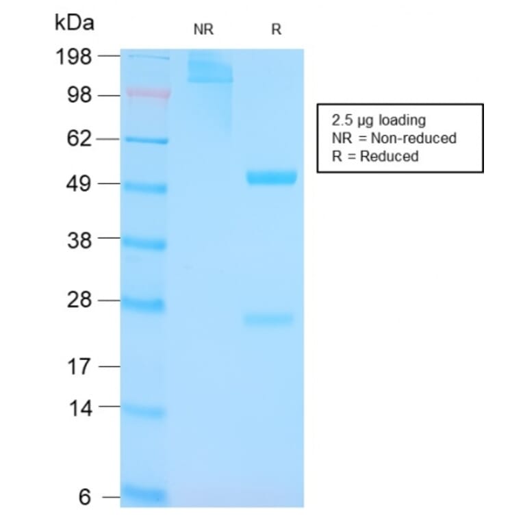 SDS-PAGE - Anti-p53 Antibody [TP53/3156R] - BSA and Azide free (A253372) - Antibodies.com