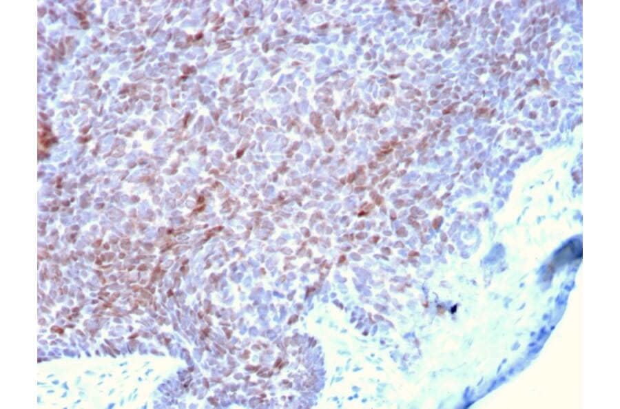 Immunohistochemistry - Anti-p73 Antibody [P73/2531] - BSA and Azide free (A253374) - Antibodies.com