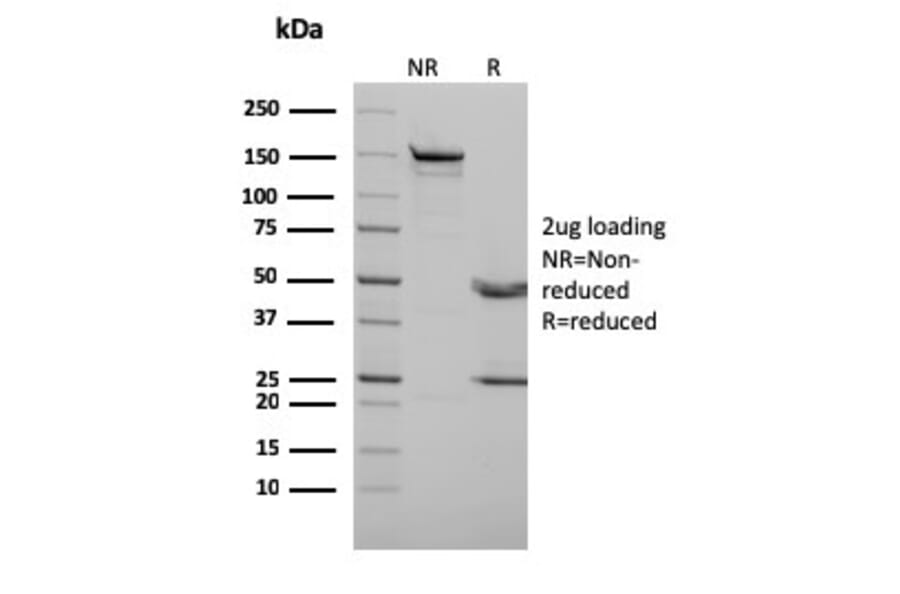SDS-PAGE - Anti-p73 Antibody [P73/2531] - BSA and Azide free (A253375) - Antibodies.com