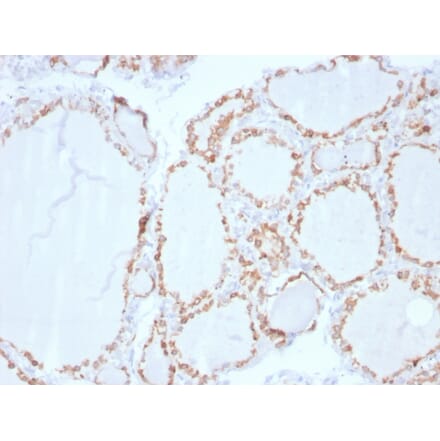 Immunohistochemistry - Anti-Thyroid Peroxidase Antibody [TPO/3702] - BSA and Azide free (A253378) - Antibodies.com