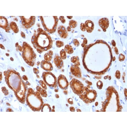 Immunohistochemistry - Anti-Thyroid Peroxidase Antibody [TPO/1921] - BSA and Azide free (A253378) - Antibodies.com