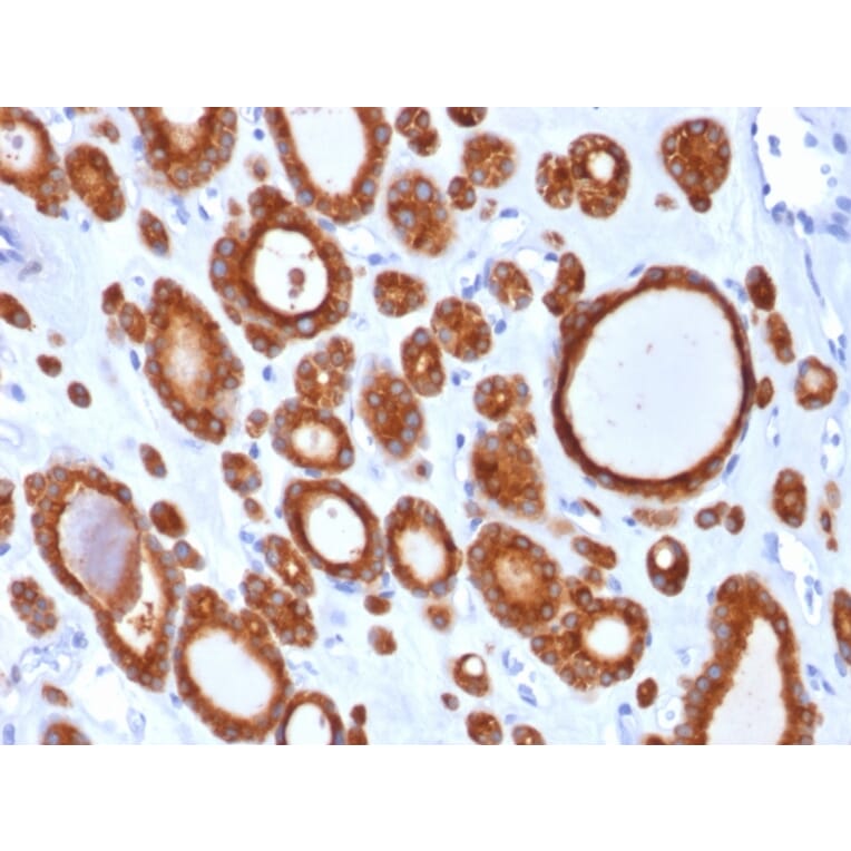 Immunohistochemistry - Anti-Thyroid Peroxidase Antibody [TPO/1921] - BSA and Azide free (A253378) - Antibodies.com