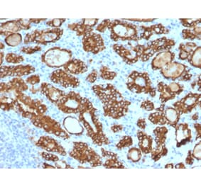 Immunohistochemistry - Anti-Thyroid Peroxidase Antibody [TPO/1922] - BSA and Azide free (A253380) - Antibodies.com