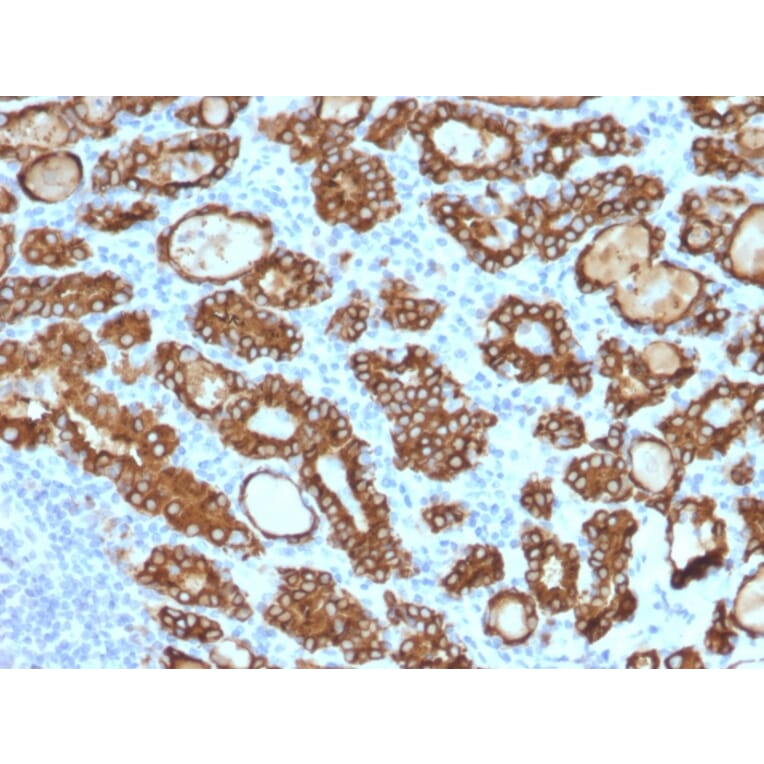 Immunohistochemistry - Anti-Thyroid Peroxidase Antibody [TPO/1922] - BSA and Azide free (A253380) - Antibodies.com