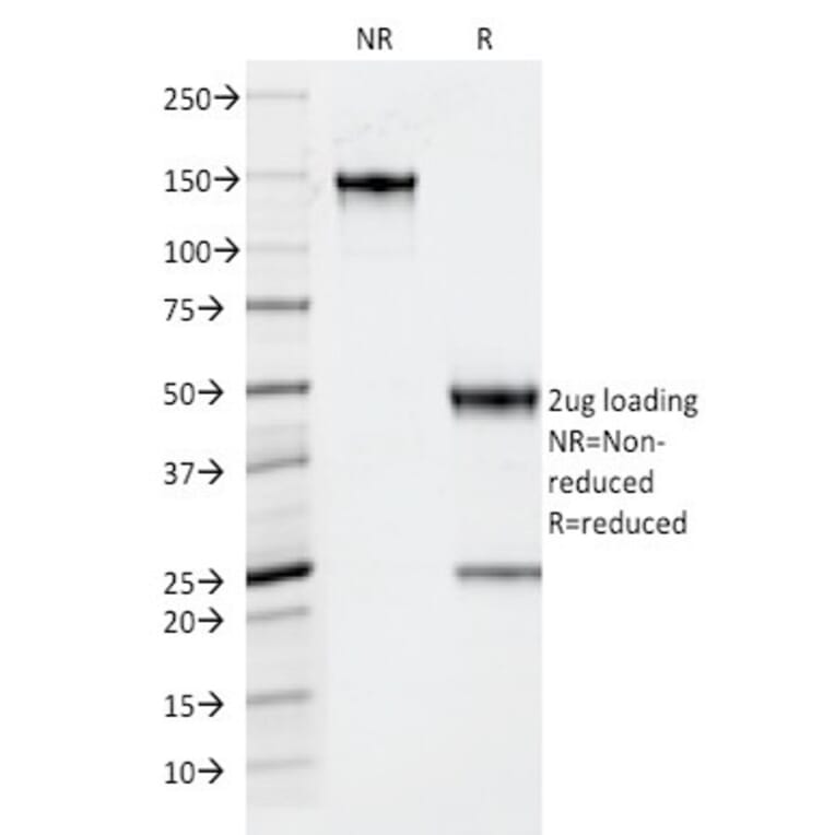 SDS-PAGE - Anti-Thyroid Peroxidase Antibody [TPO/1922] - BSA and Azide free (A253380) - Antibodies.com