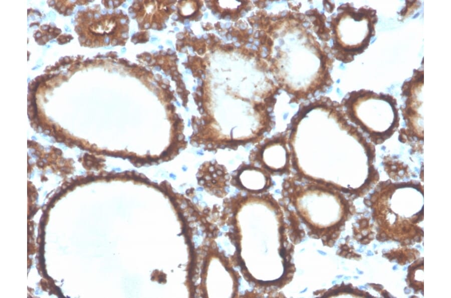 Immunohistochemistry - Anti-Thyroid Peroxidase Antibody [TPO/3694] - BSA and Azide free (A253381) - Antibodies.com