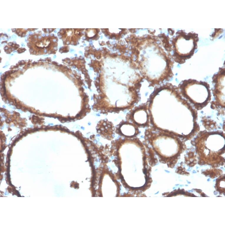Immunohistochemistry - Anti-Thyroid Peroxidase Antibody [TPO/3694] - BSA and Azide free (A253381) - Antibodies.com