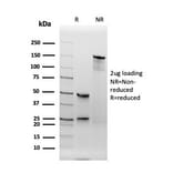 SDS-PAGE - Anti-Thyroid Peroxidase Antibody [TPO/3694] - BSA and Azide free (A253381) - Antibodies.com