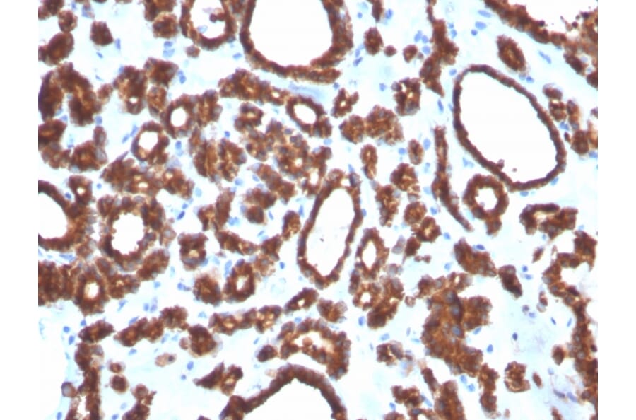 Immunohistochemistry - Anti-Thyroid Peroxidase Antibody [TPO/3697] - BSA and Azide free (A253383) - Antibodies.com