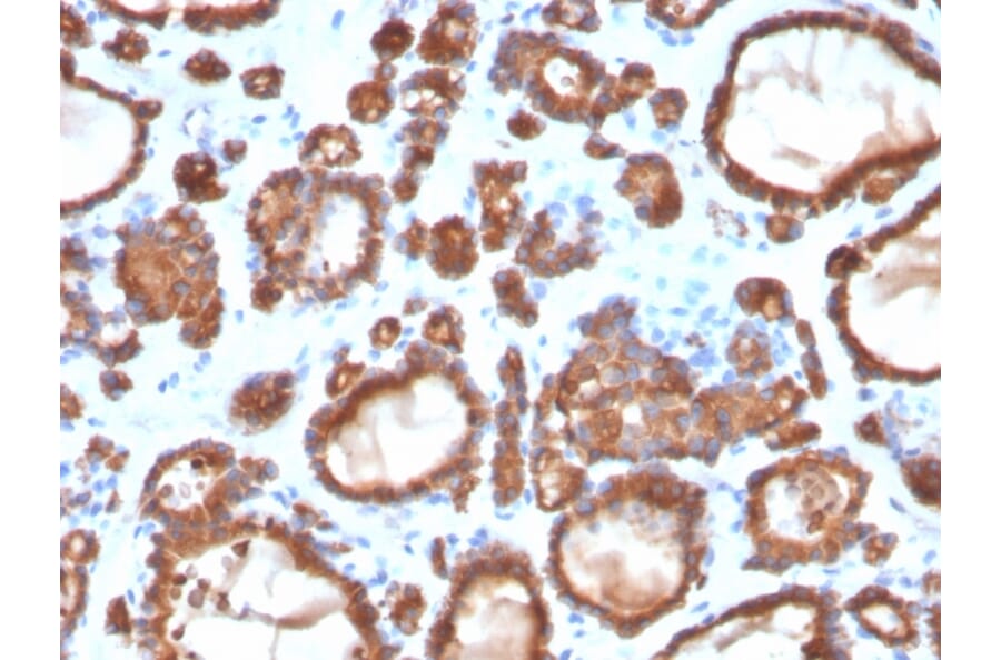 Immunohistochemistry - Anti-Thyroid Peroxidase Antibody [TPO/3697] - BSA and Azide free (A253383) - Antibodies.com