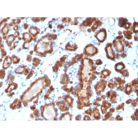 Immunohistochemistry - Anti-Thyroid Peroxidase Antibody [TPO/3698] - BSA and Azide free (A253384) - Antibodies.com
