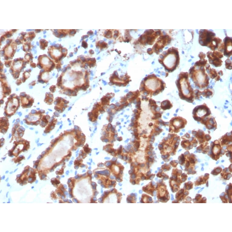 Immunohistochemistry - Anti-Thyroid Peroxidase Antibody [TPO/3698] - BSA and Azide free (A253384) - Antibodies.com