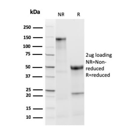 SDS-PAGE - Anti-Thyroid Peroxidase Antibody [TPO/3813R] - BSA and Azide free (A253385) - Antibodies.com