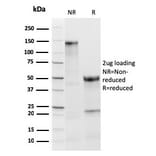 SDS-PAGE - Anti-Thyroid Peroxidase Antibody [TPO/3813R] - BSA and Azide free (A253385) - Antibodies.com