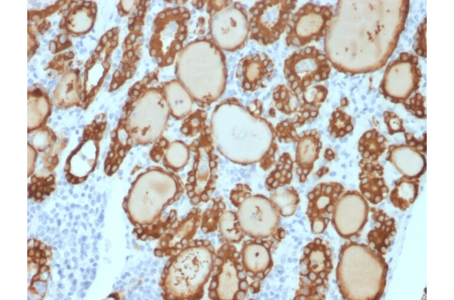 Immunohistochemistry - Anti-Thyroid Peroxidase Antibody [TPO/3813R] - BSA and Azide free (A253384) - Antibodies.com