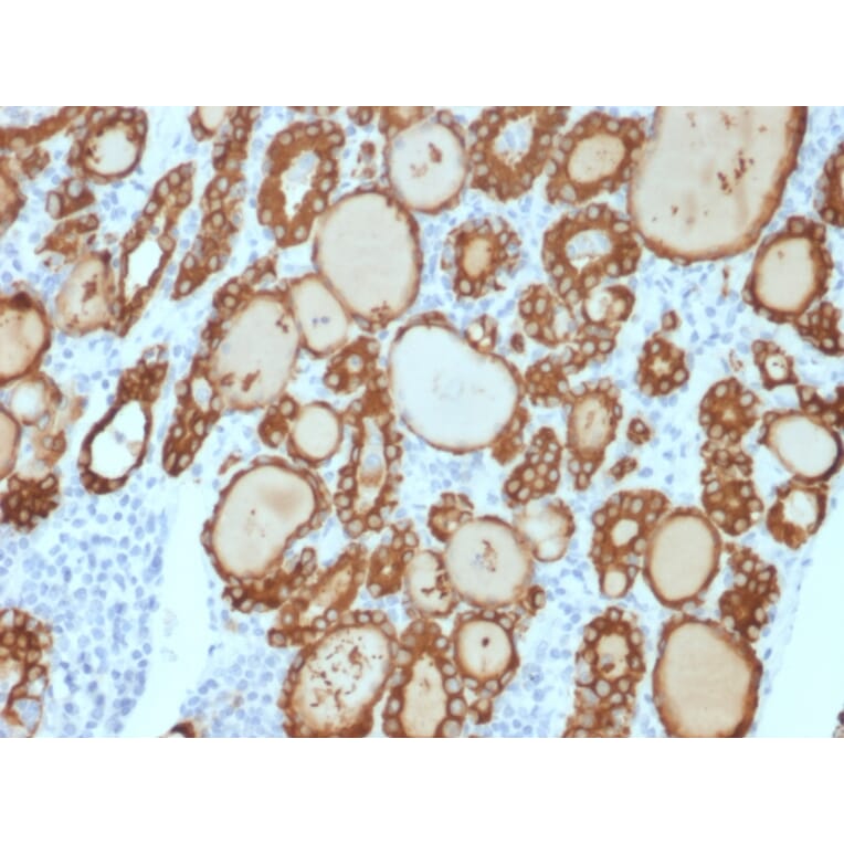 Immunohistochemistry - Anti-Thyroid Peroxidase Antibody [TPO/3813R] - BSA and Azide free (A253384) - Antibodies.com