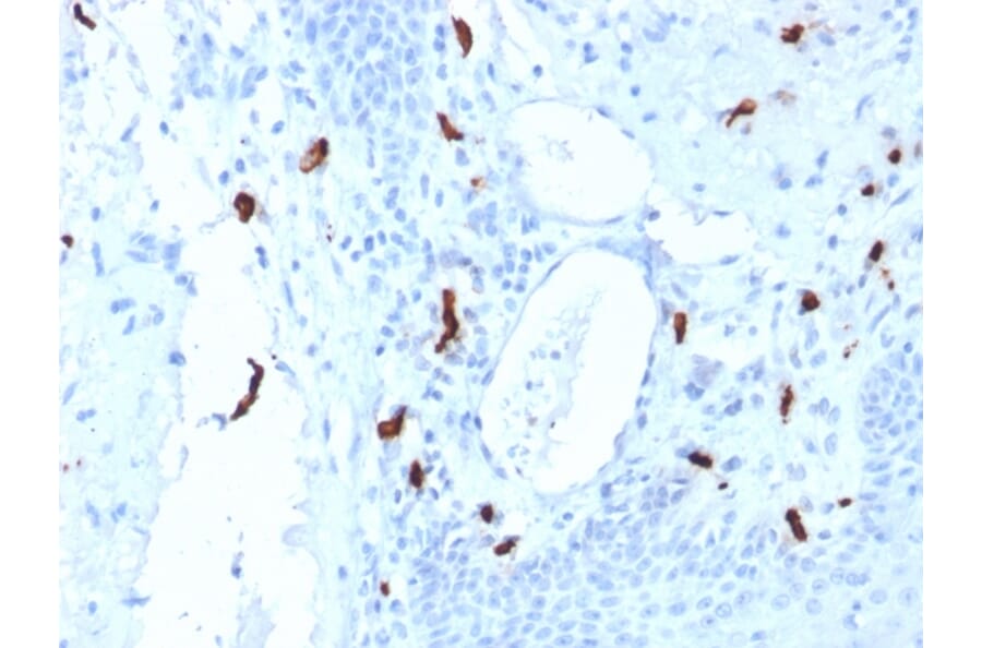 Immunohistochemistry - Anti-Mast Cell Tryptase Antibody [TPSAB1/1961] - BSA and Azide free (A253386) - Antibodies.com