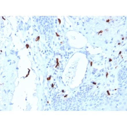 Immunohistochemistry - Anti-Mast Cell Tryptase Antibody [TPSAB1/1961] - BSA and Azide free (A253386) - Antibodies.com