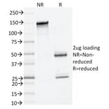 SDS-PAGE - Anti-Mast Cell Tryptase Antibody [TPSAB1/1961] - BSA and Azide free (A253386) - Antibodies.com