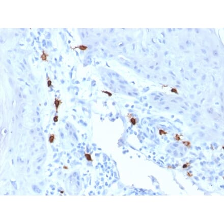 Immunohistochemistry - Anti-Mast Cell Tryptase Antibody [TPSAB1/1963] - BSA and Azide free (A253386) - Antibodies.com